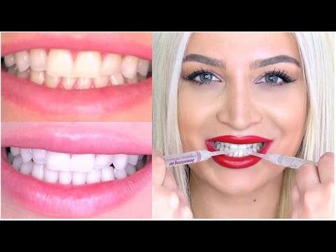 teeth whitening from dentist instructions